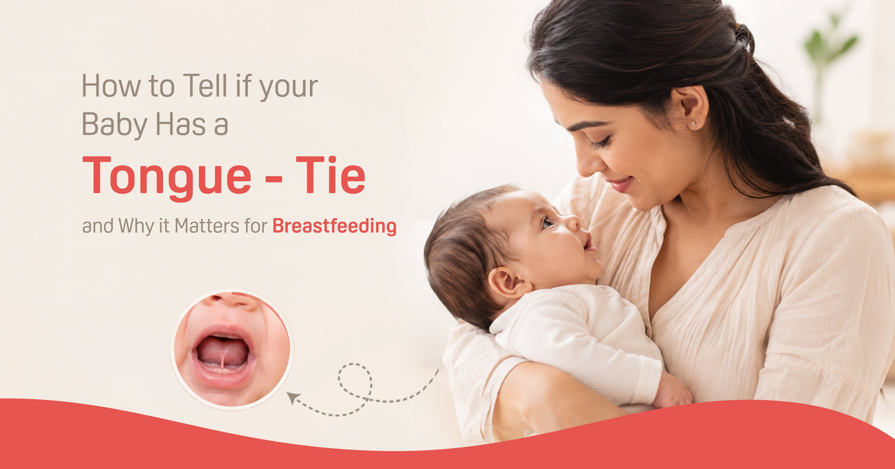 How to Tell if Your Baby Has a Tongue-Tie and Why It Matters for Breastfeeding